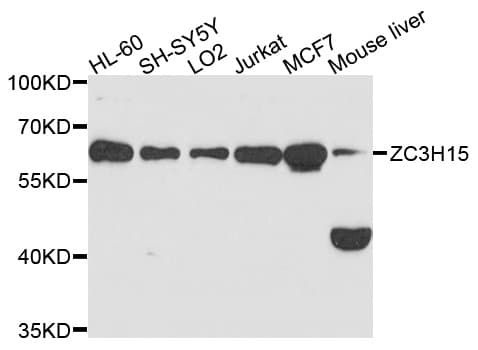 LEREPO4 / ZC3H15 Antibody
