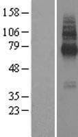 TMEM104 Protein (Over-Expression Lysate Myc-DDK (Flag))