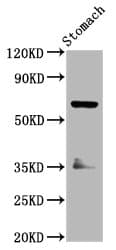 SLC5A5 / NIS Antibody