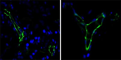 IHC-plus™ Monoclonal Mouse anti-Human PECAM-1 / CD31 Antibody (clone 2F7B2, IHC, IF, WB)