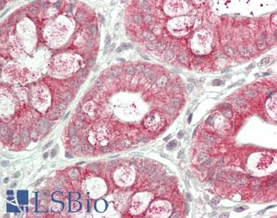 IHC-plus™ Polyclonal Rabbit anti-Human TRIAP1 Antibody (IHC, IF, WB)