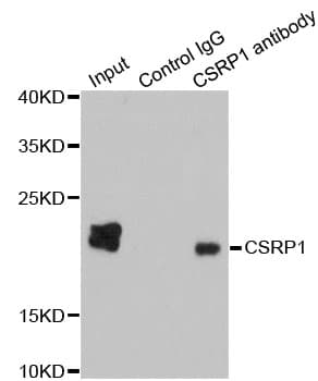 Polyclonal Rabbit anti-Human CSRP1 Antibody (IHC, IF, WB)
