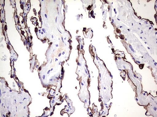 KRT7 / CK7 / Cytokeratin 7 Antibody (aa1-114, clone UMAB161)
