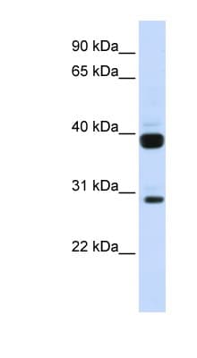 FLT3LG / Flt3 Ligand Antibody (N-Terminus)