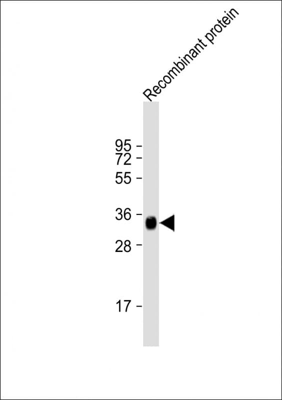 LRP1B Antibody (clone 1642CT736.5.59)