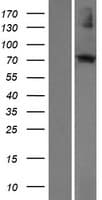 ECM2 Protein (Over-Expression Lysate Myc-DDK (Flag))