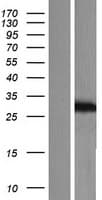 KCNIP2 / KCHIP2 Protein (Over-Expression Lysate Myc-DDK (Flag))