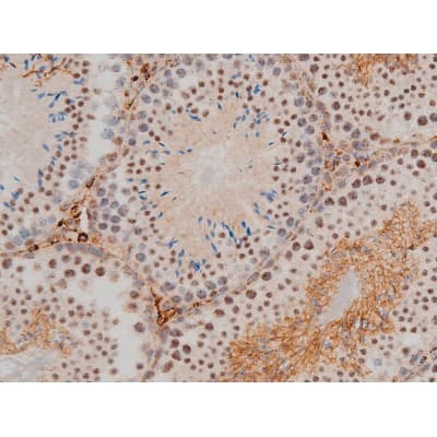 AP-1 / JUND Antibody (phospho-Ser255)