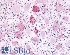 PathPlus™ MRGPRX4 / MRGX4 Antibody (C-Terminus)