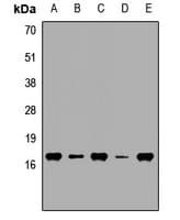 HPCAL1 / Hippocalcin-Like 1 Antibody