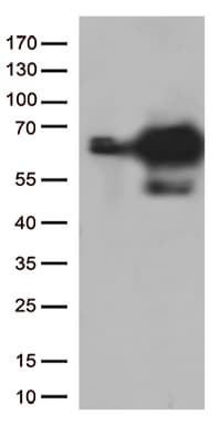 PRCC / RCCP1 Antibody (aa135-491, clone OTI5G7, Carrier-free)