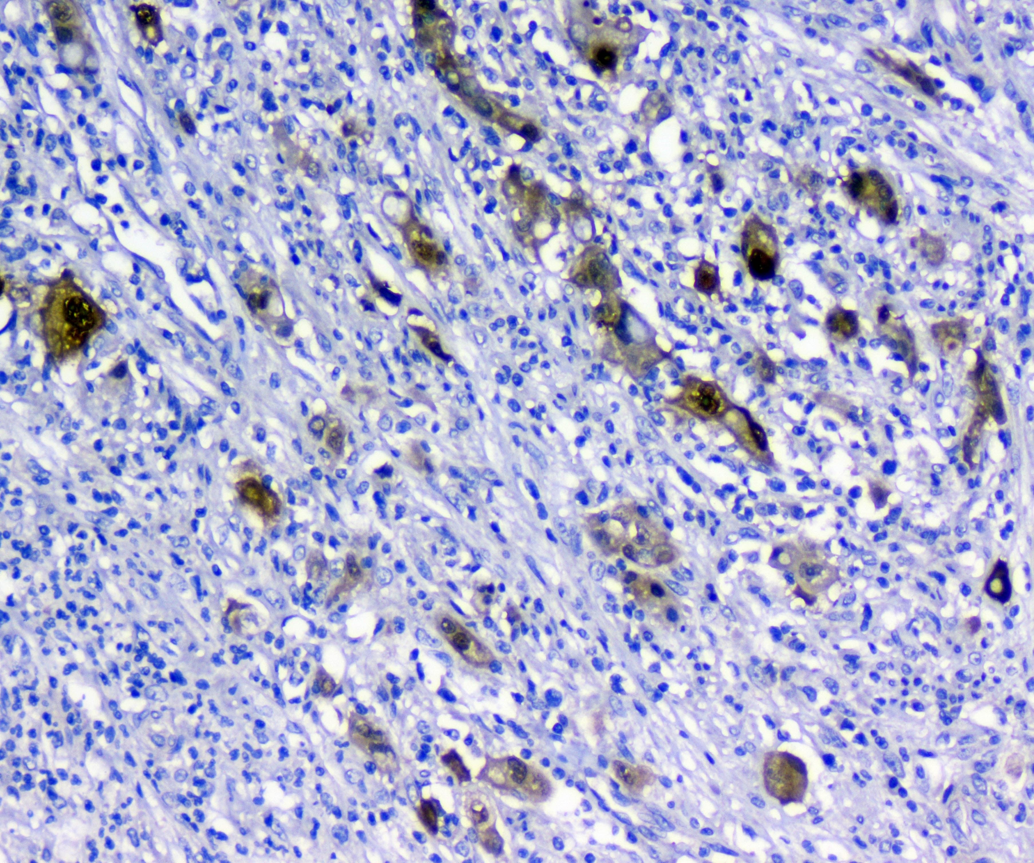 Polyclonal Rabbit anti-Human SFN / Stratifin / 14-3-3 Sigma Antibody (WB)