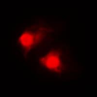 RARB / RAR Beta Antibody (C-Terminus)
