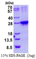 Human SIX6 Protein (Recombinant His)