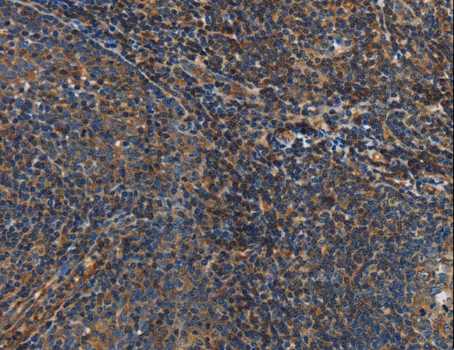 IL17D Antibody
