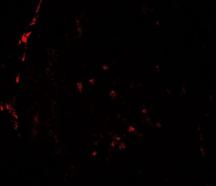 Polyclonal Rabbit anti-Human HDAC2 Antibody (IHC, IF, WB)