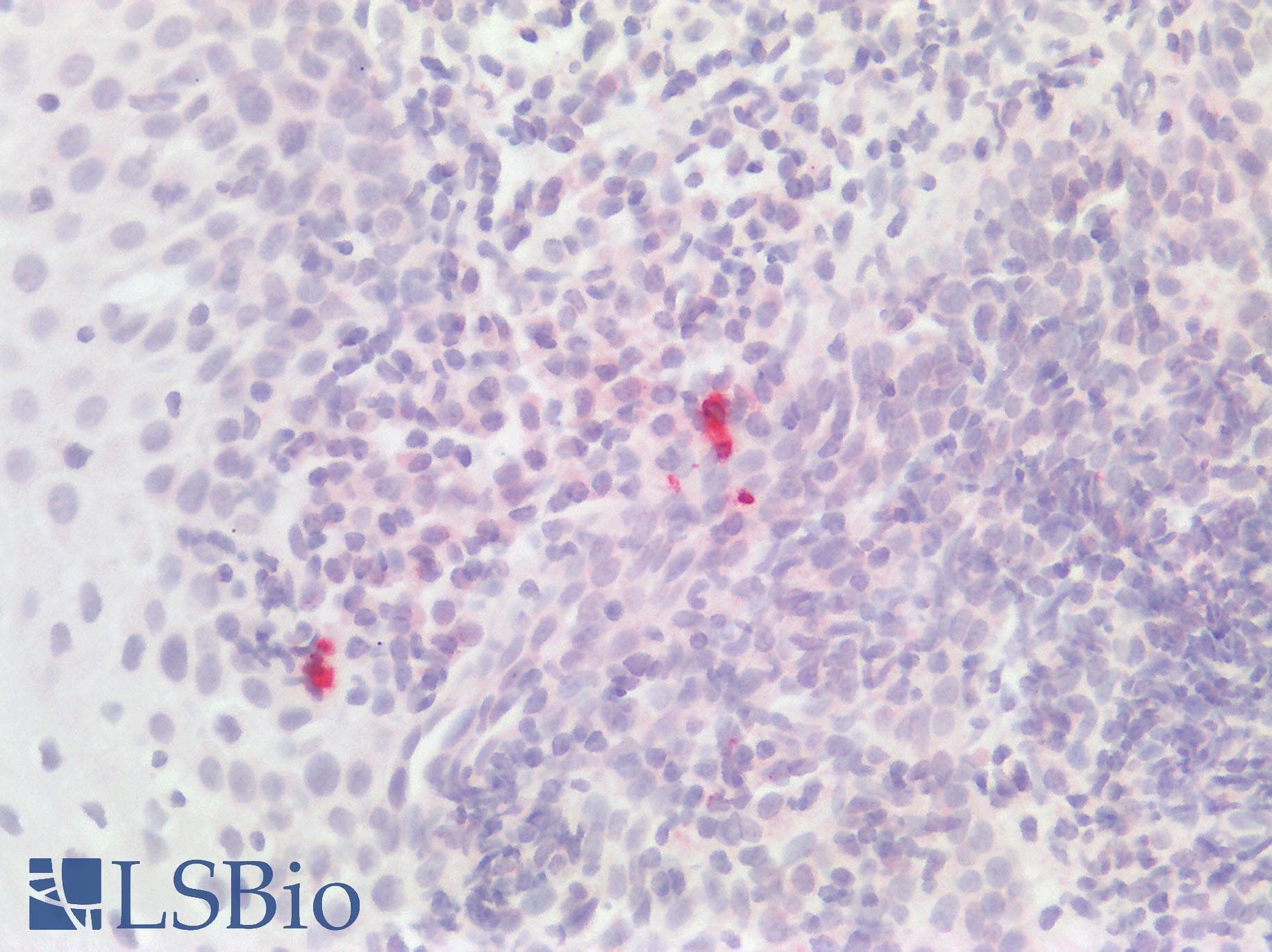 IHC-plus™ IL1F9 Antibody (clone 2F4)