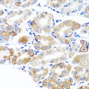 Polyclonal Rabbit anti-Human DLG1 / SAP97 Antibody (IHC, WB)