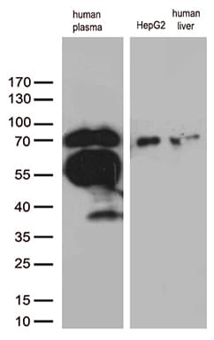 Monoclonal Mouse anti-Human F2 / Prothrombin / Thrombin Antibody (clone OTI5B11, aa44-622, WB)