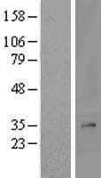 MRPL2 Protein (Over-Expression Lysate Myc-DDK (Flag))