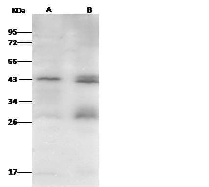 Polyclonal Rabbit anti-Human JAM2 Antibody (Preservative Free, IHC, WB)