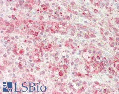 IHC-plus™ Polyclonal Rabbit anti-Human LF / LTF / Lactoferrin Antibody (IHC)