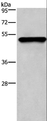 KRT14 / CK14 / Cytokeratin 14 Antibody