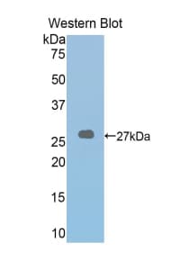 LOXL2 Antibody (aa553-761)