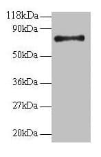 RPS18 / Ribosomal Protein S18 Antibody
