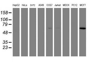 AKT1 Antibody (clone OTI2B9)