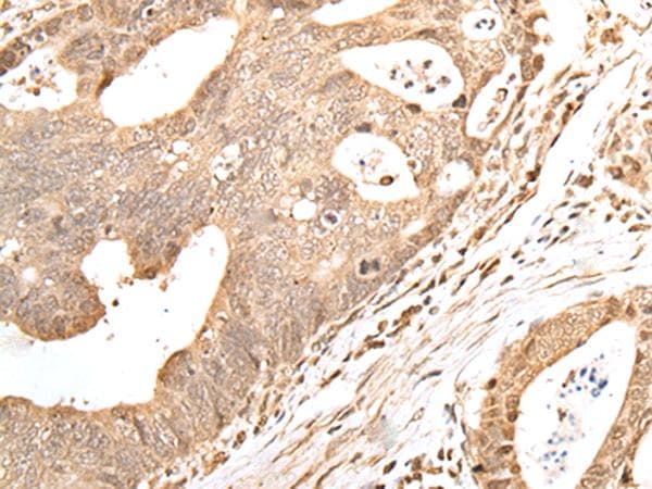 GRAP Antibody