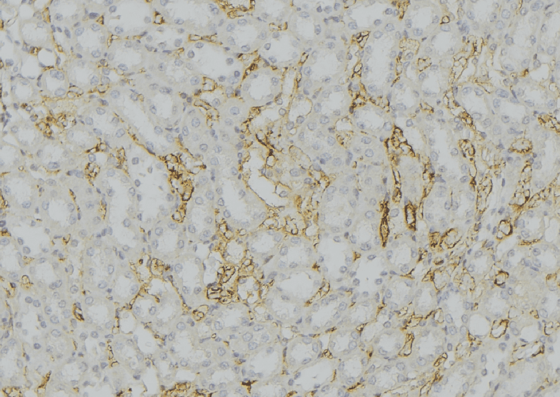 CYP11B2 / Aldosterone Synthase Antibody
