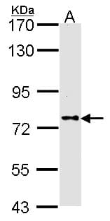IHC-plus™ Polyclonal Rabbit anti-Human Dipeptidylpeptidase 8 / DPP8 Antibody (IHC, IF, WB)