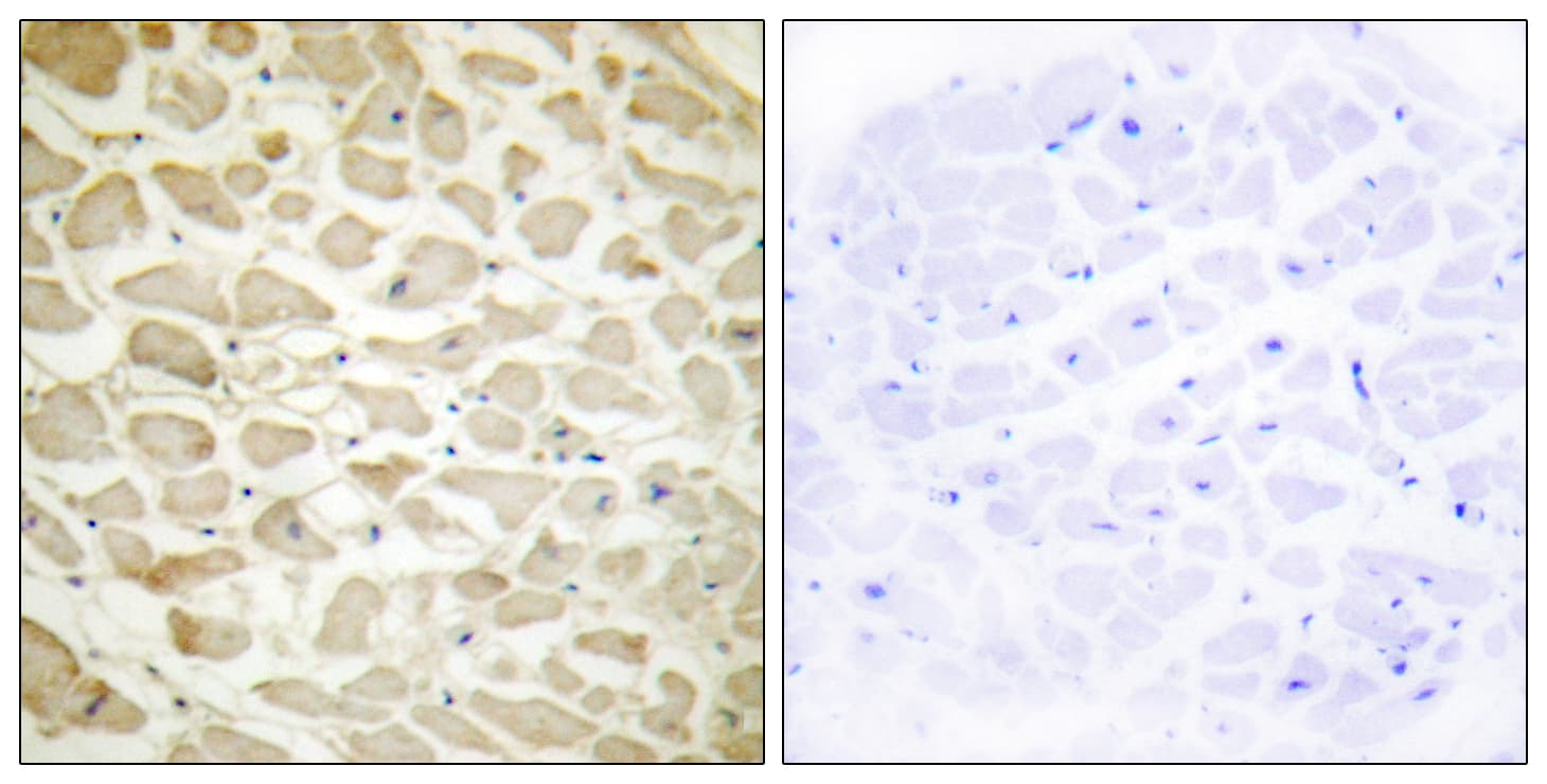 COL14A1 / Collagen XIV Antibody (aa71-120)