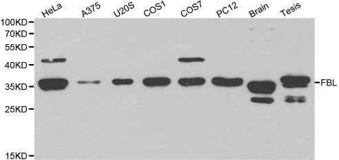 FBL / FIB / Fibrillarin Antibody