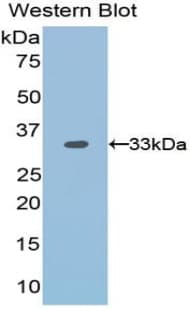 OTUB1 / OTU1 Antibody (aa1-271)
