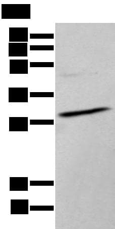 Polyclonal Rabbit anti-Human HOXC9 Antibody (IHC, WB)