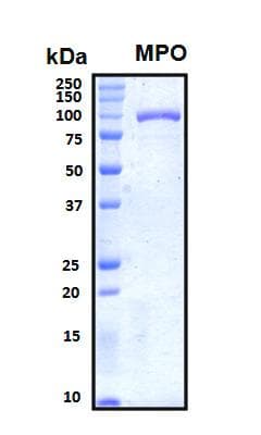 Human MPO / Myeloperoxidase Protein (Recombinant His, N-Terminal)