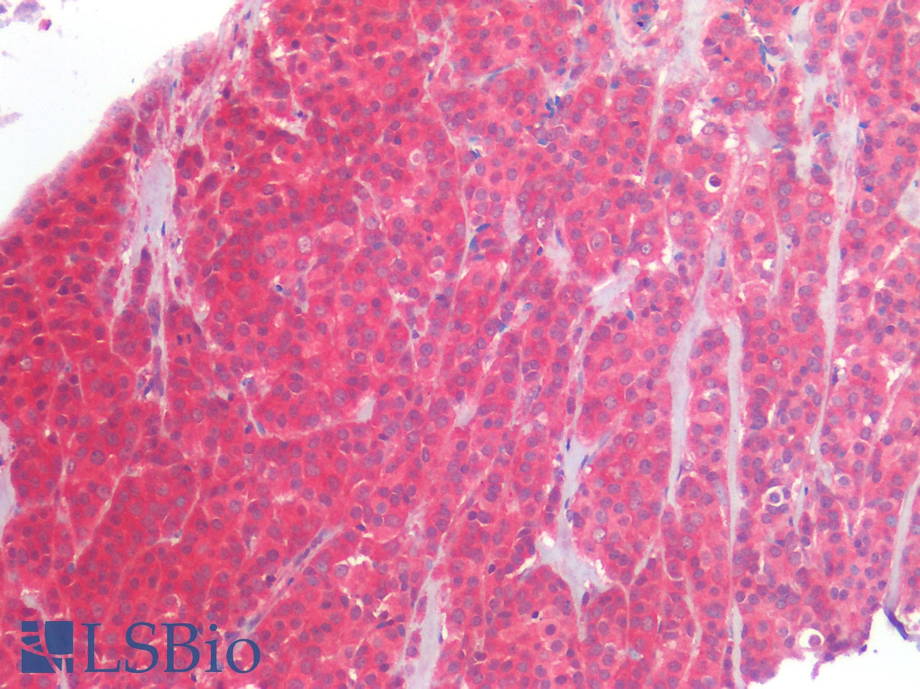 IHC-plus™ ERBB2 / HER2 Antibody