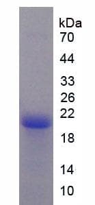 Human ATRN / Attractin Protein (Recombinant His, N-Terminal)