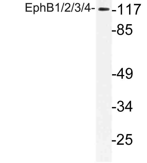 EPHB1 + EPHB2 + EPHB3 + EPHB4 Antibody (Tyr594)