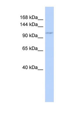ZC3H7B Antibody (aa395-444)