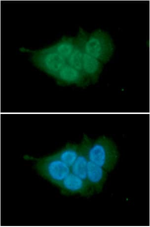 MCM7 Antibody (clone AT118H7)