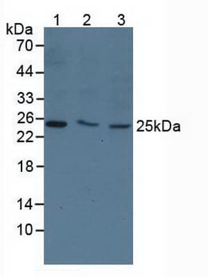 TK1 / TK / Thymidine Kinase Antibody (aa2-234, APC)