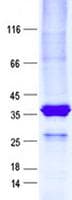 Human RPP14 Protein (Recombinant GST, N-terminus + His, C-terminus)