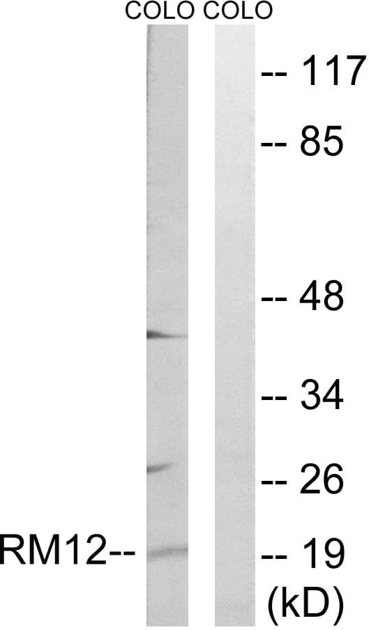 Polyclonal Rabbit anti-Human MRPL12 Antibody (aa31-80, WB)