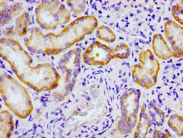 Polyclonal Rabbit anti-Human CRTC2 / TORC2 Antibody (IHC, IF)