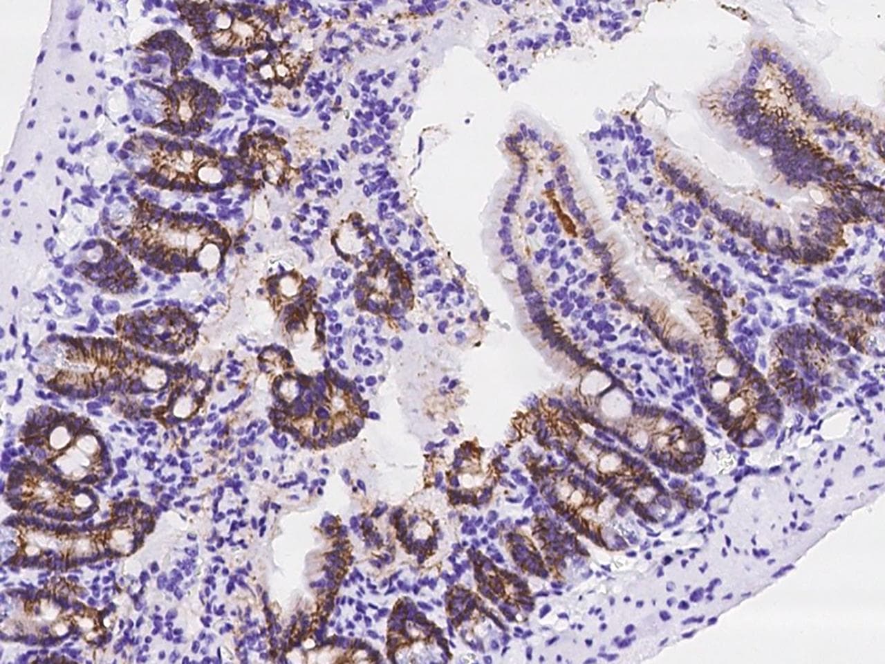 Polyclonal Rabbit anti-Mouse CA9 / Carbonic Anhydrase IX Antibody (IHC)