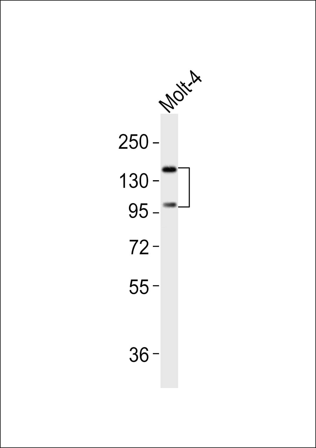 Polyclonal Rabbit anti-Human INPP5D / SHIP1 / SHIP Antibody (WB)