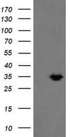 MMACHC Antibody (clone OTI6B5)